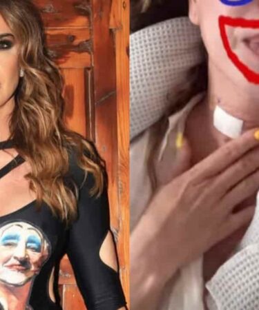 luciana-gimenez-fala-em-tortura-apos-cirurgia-de-emergencia-pescoco-muito-inchado_2107