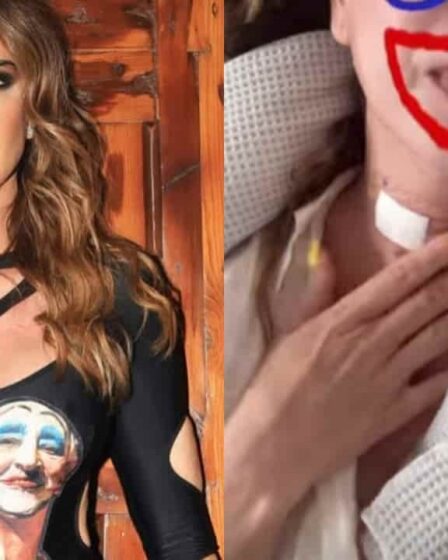 luciana-gimenez-fala-em-tortura-apos-cirurgia-de-emergencia-pescoco-muito-inchado_2107
